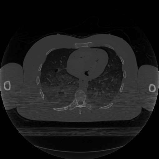 CT Image from Visible Human Data Set