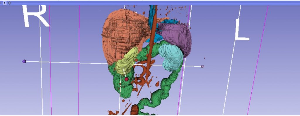 Segmenting the organs using 3DSlicer.