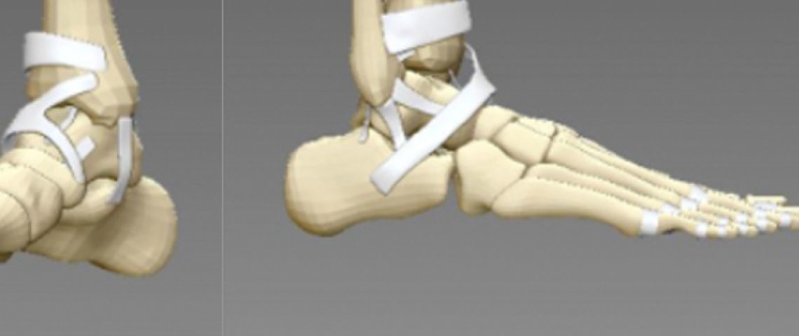 Pocket Anatomy Connective Tissue Pocket Anatomy Connective Tissue